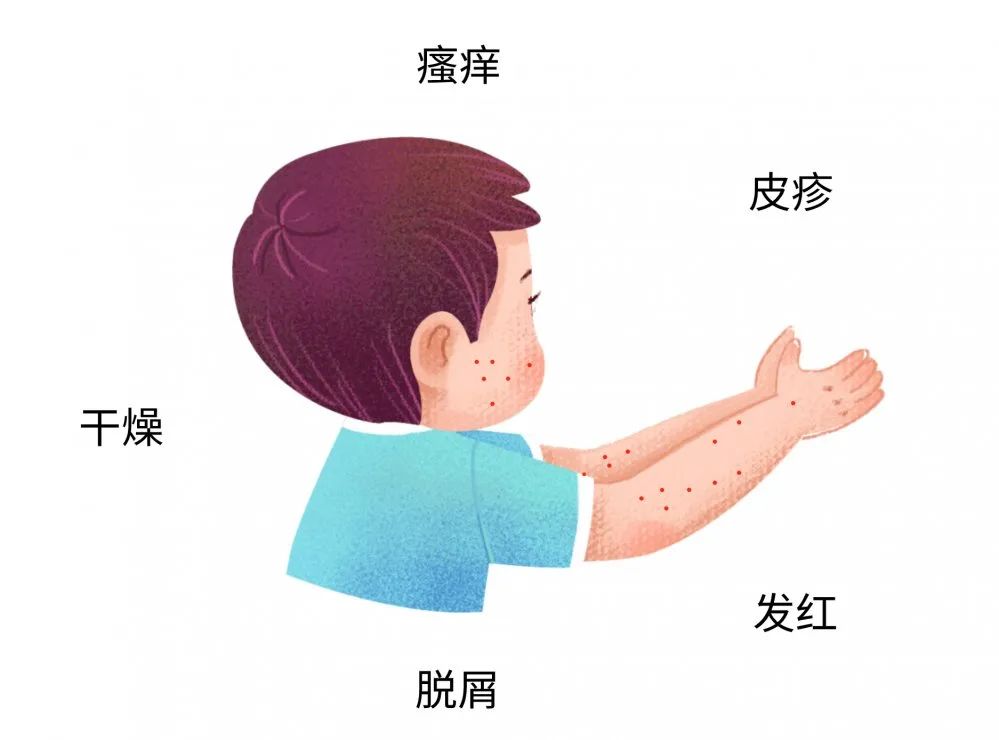 这些症状都可能是宝宝过敏传递的信号，，，很多宝妈还不知道